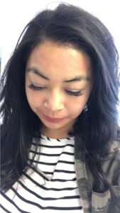 what-is-microneedling