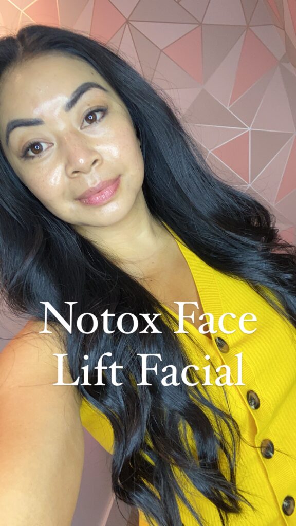 notox botox